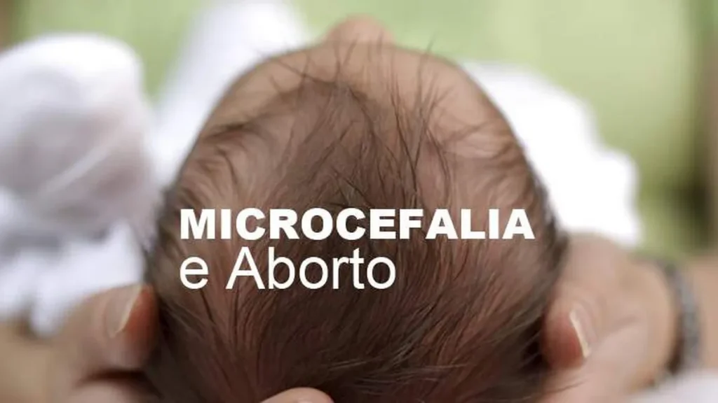 Imagem destaque microsefalia e aborto do artigo Teólogo fala sobre a questão da microcefalia e o aborto