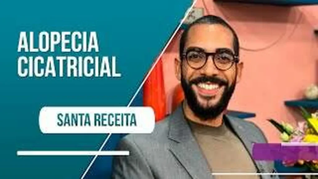 Imagem queda de cabelo entenda o que e alopecia cicat do artigo Queda de cabelo: entenda o que é alopecia cicatricial